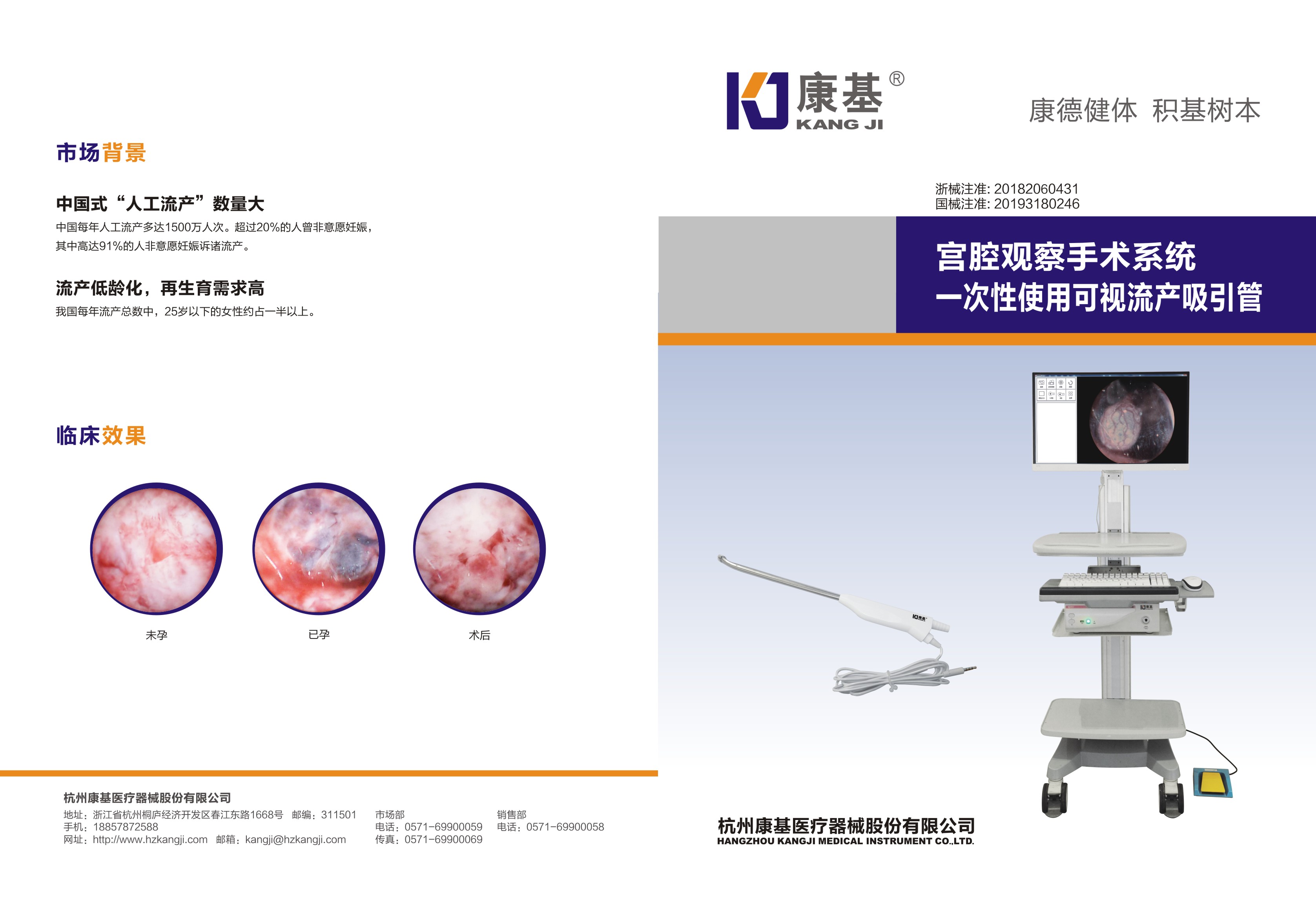 一(yī)次性宮腔觀察系統2 (1).jpg